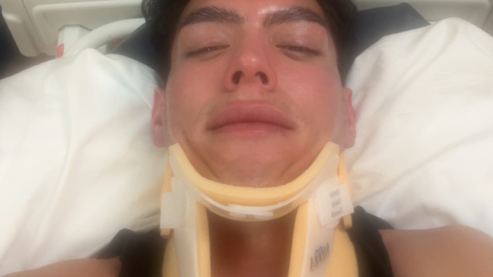 Help Hex Recover After Hit-and-Run campaign photo, 1 of 3
