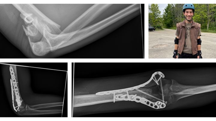 Fundraiser by Josh Rinaldi : Josh Rinaldi is hurt and needs our help!