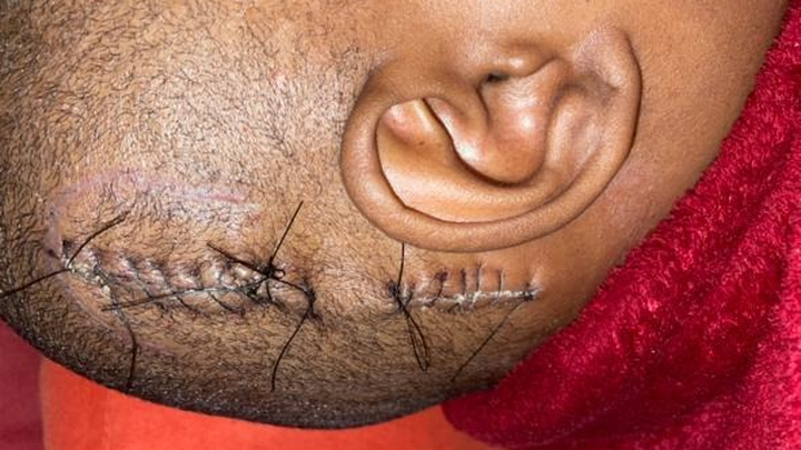 Help Nokukhanya Get Life-Saving Surgery campaign photo, 1 of 8