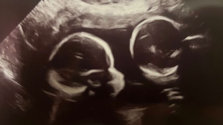Foto principale della raccolta fondi