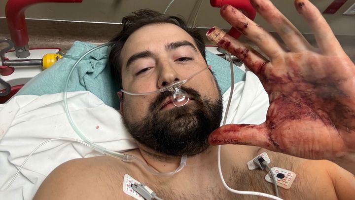 Fundraiser by George Davis : Support George’s Recovery After Austin Attack