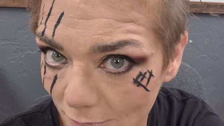 Support Mickie Knuckles' Healing Journey campaign photo, 1 of 5