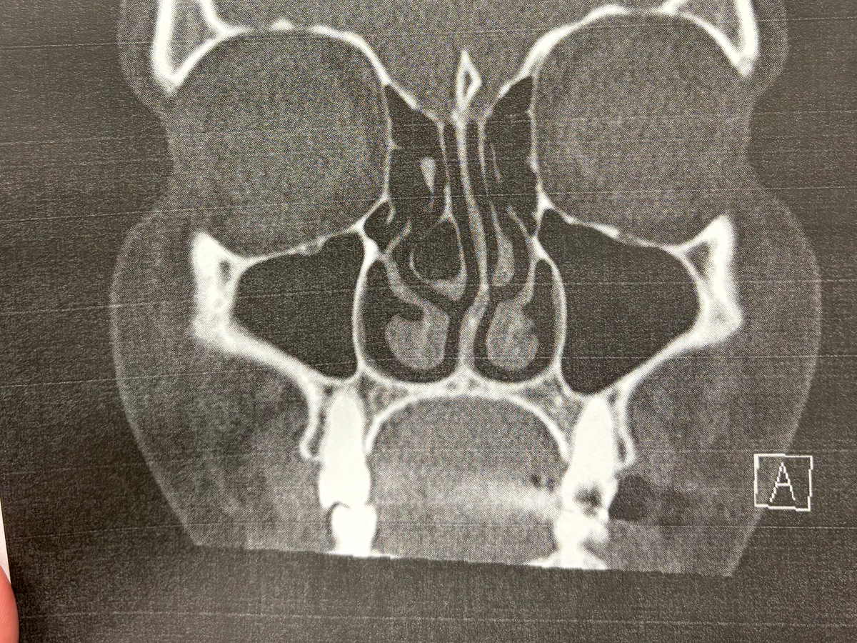 Fundraiser’s main image