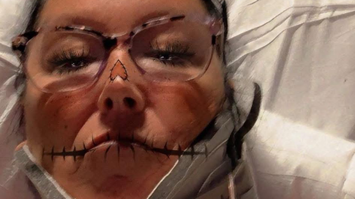 Help Alycia's Mom Heal from Surgery campaign photo, 1 of 3