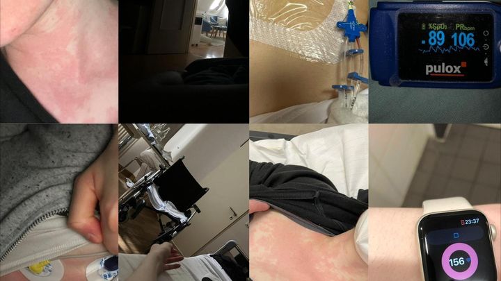 Help Michala Fight ME CFS and Multiple Chronic Illnesses campaign photo, 1 of 8