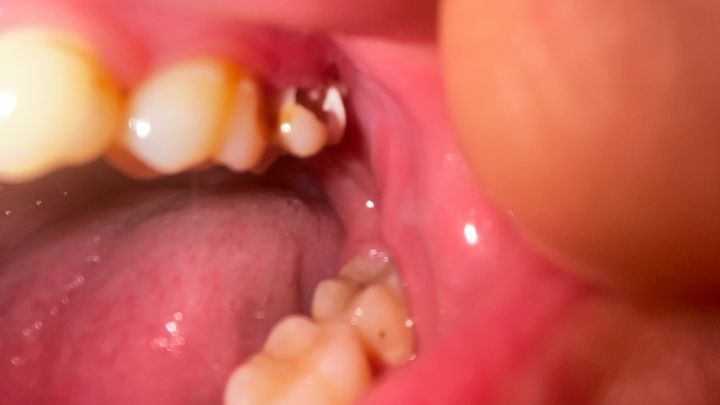 Help Me Get Emergency Dental Care campaign photo, 1 of 5
