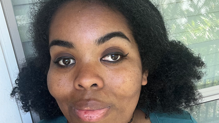 Donate to Ease Beth's Medical Burden campaign photo, 1 of 3