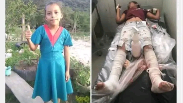 Ayuda a Ximena para que pueda solventar sus gastos médicos campaign photo, 1 of 3