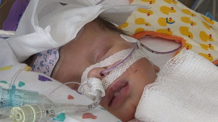 Help Angel Fight Hypoplastic Left Heart Syndrome campaign photo, 1 of 11