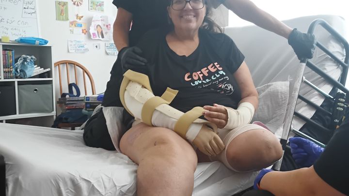 Fundraiser by Heather Fowler : Support Recovery After Devastating Dog ...
