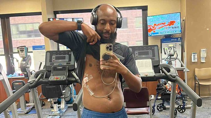 He Survived Cardiac Death—Lost Gym-Help Rebuild campaign photo, 1 of 3