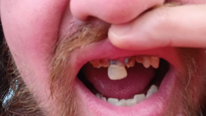 Emergency Dental Help for Chris campaign photo, 1 of 4