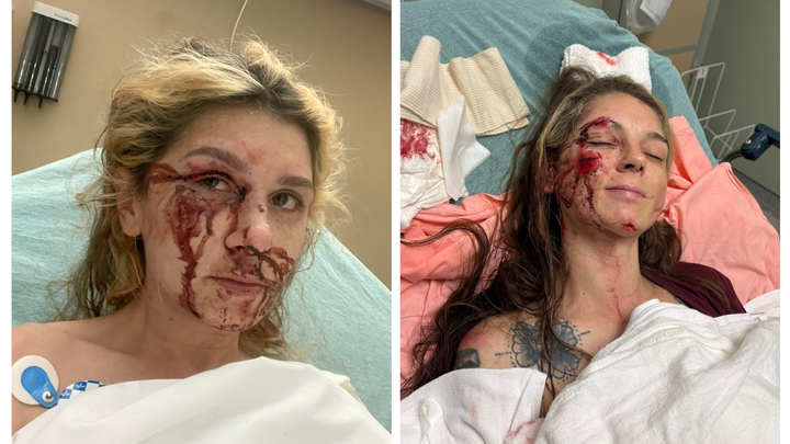 Help Maria and Desere Heal After Tragic Accident campaign photo, 1 of 7