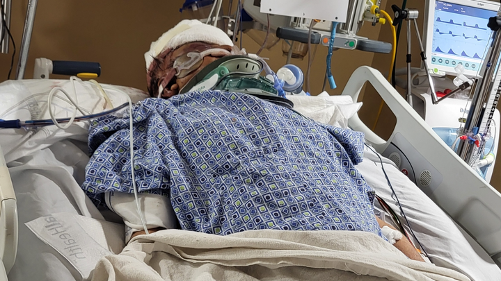 Support for My Father-in-Law's Critical Recovery campaign photo, 1 of 7