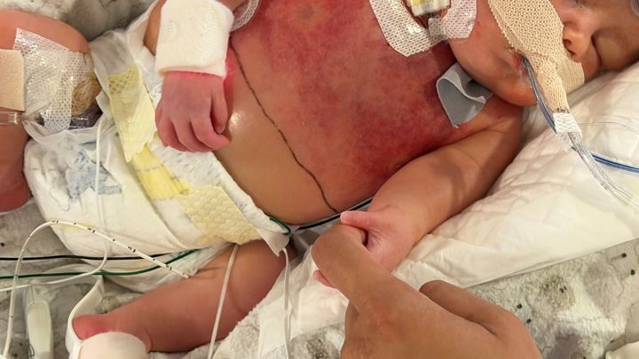 Support Baby Trajan and the Witikko Family campaign photo, 1 of 3