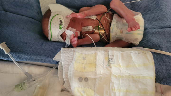 Support for NICU Baby and Family campaign photo, 1 of 6