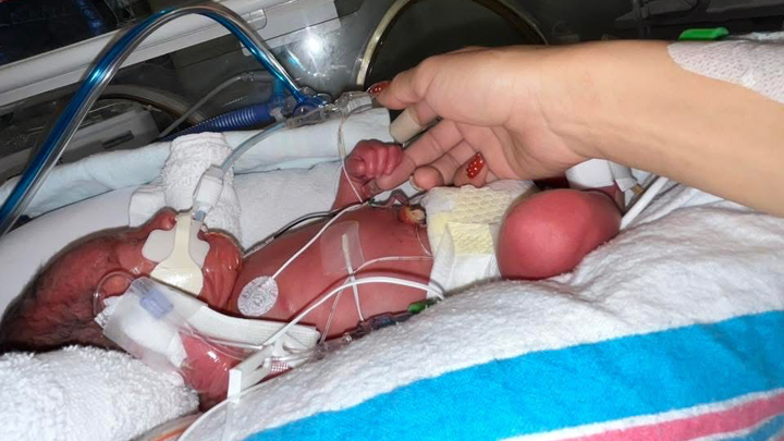 Relief for Sierra’s Family Facing Health & Financial Strain campaign photo, 1 of 7