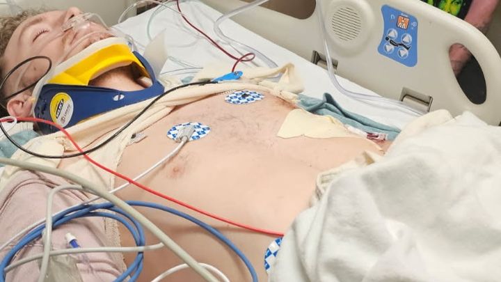 Fundraiser by Jacob Hardwick : Support Jacob’s Recovery After Accident