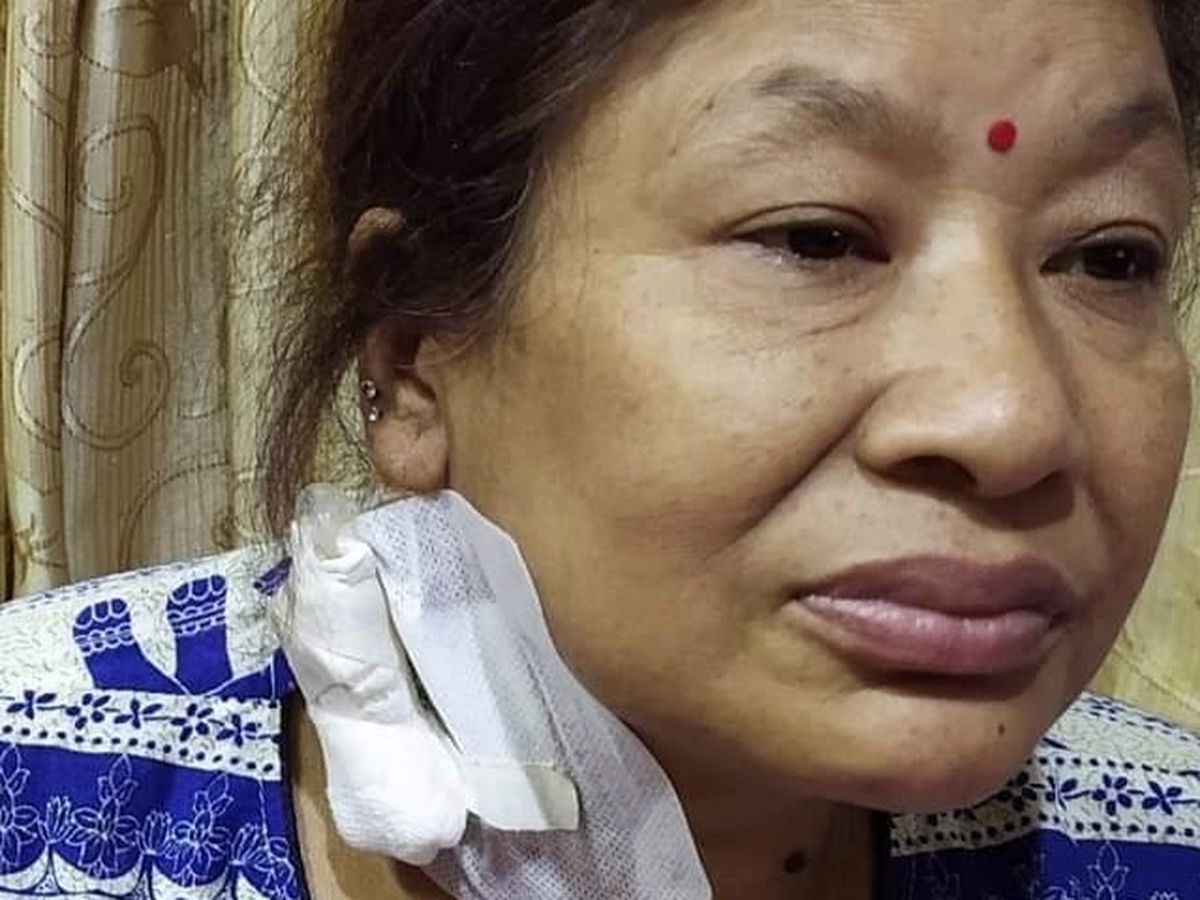 Subha's urgent kidney transplant and support fund campaign photo, 1 of 2