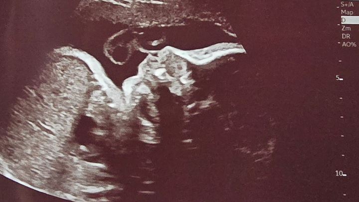 Help Us Prepare for Our New Baby's Arrival campaign photo, 1 of 4