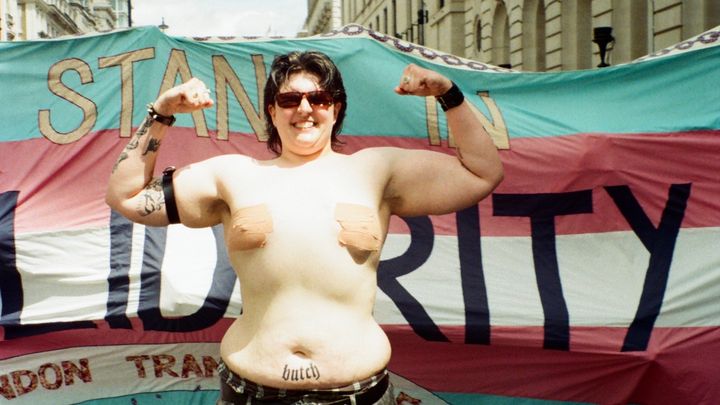Em’s Top Surgery campaign photo, 1 of 8