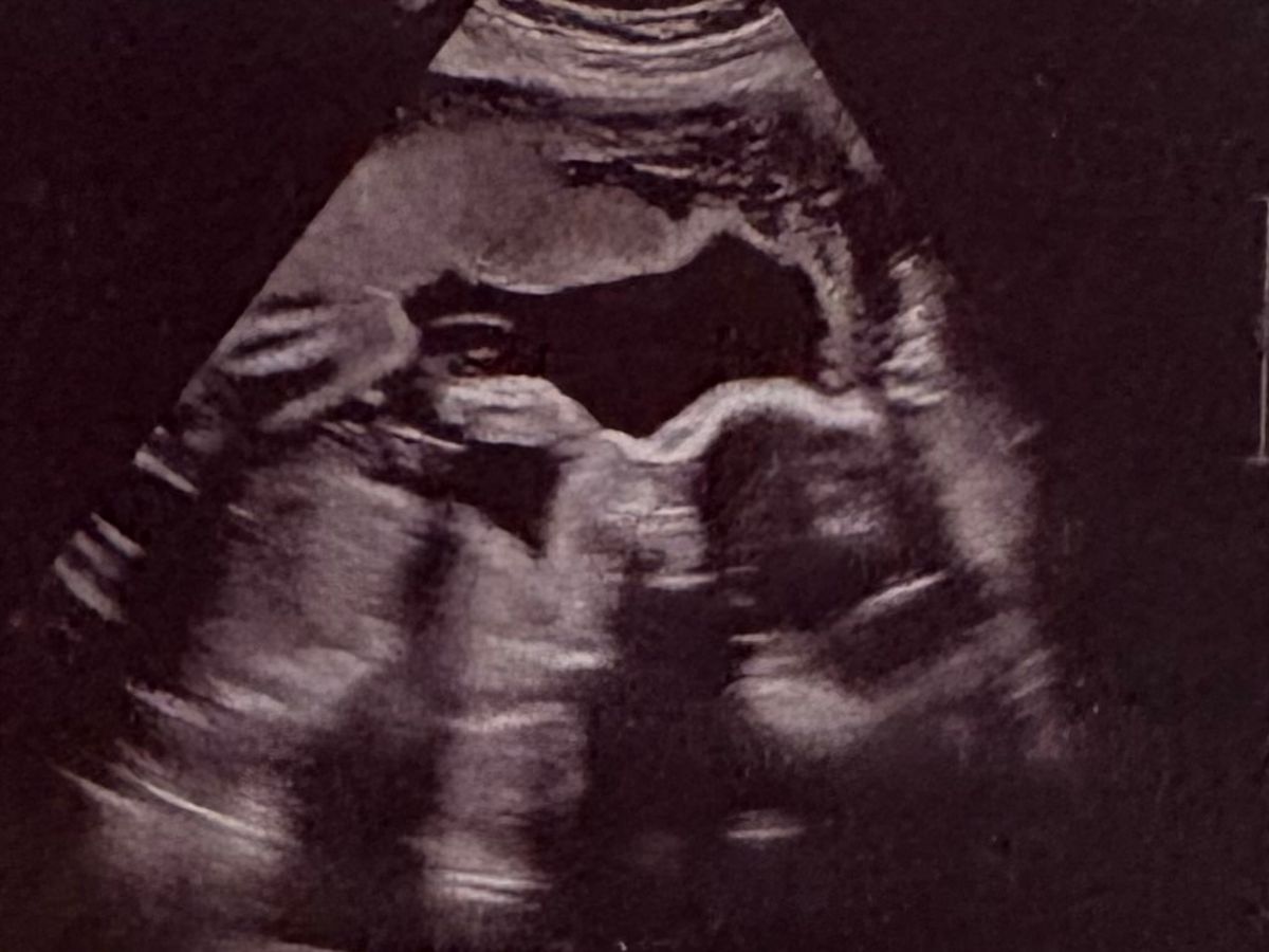 Fundraiser’s main image