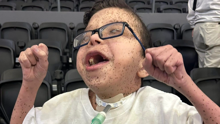 Help Brody Access His Community campaign photo, 1 of 6
