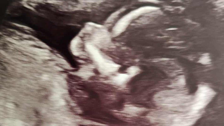 Help Abigail's Family Honor Baby Ryatt campaign photo, 1 of 3