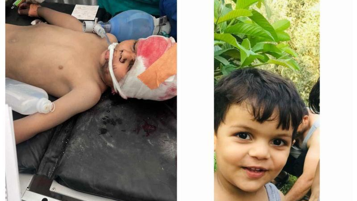 Medical care for Mustafa, child survivor of bombing campaign photo, 1 of 8