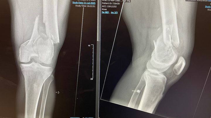 Victim of a hit and run campaign photo, 1 of 7
