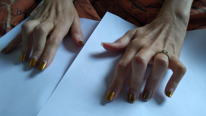 Help Me Save the Use of My Hands campaign photo, 1 of 8