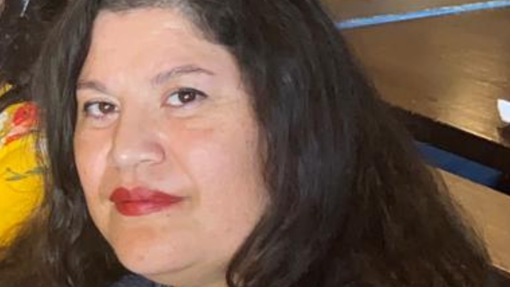 Help Claudia Overcome Keratoconus campaign photo, 1 of 4