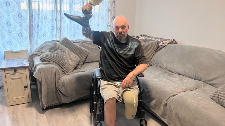 Help Ricardo Recover and Rebuild After Amputation campaign photo, 1 of 6