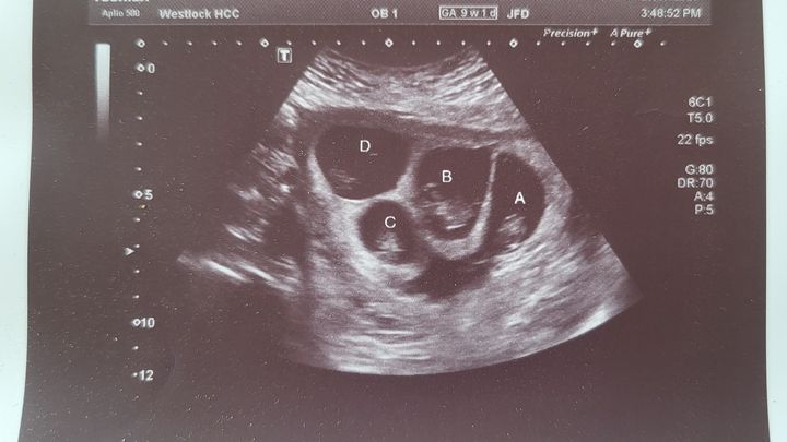 Westlock County Quadruplets campaign photo, 1 of 5