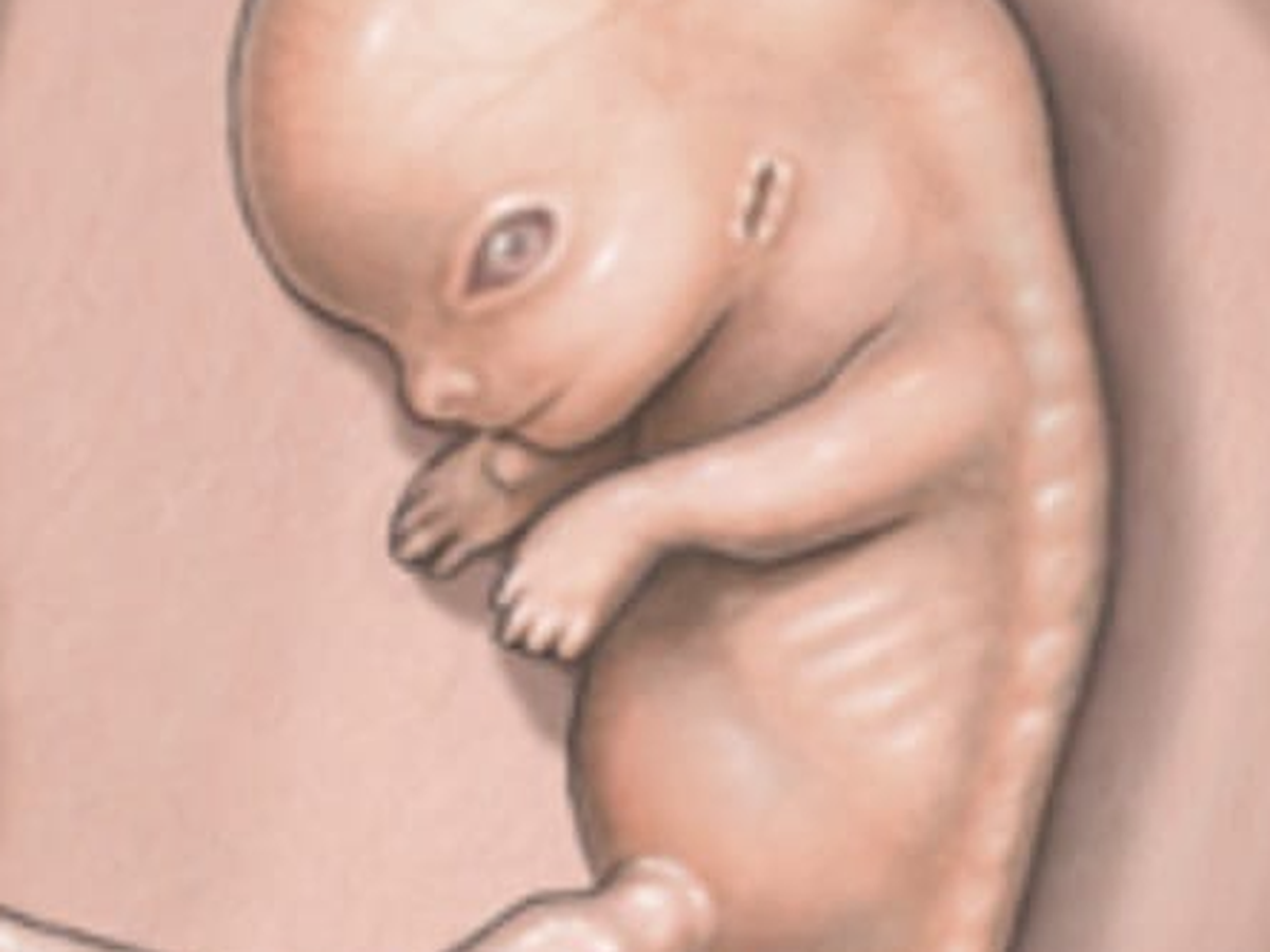 Fundraiser’s main image