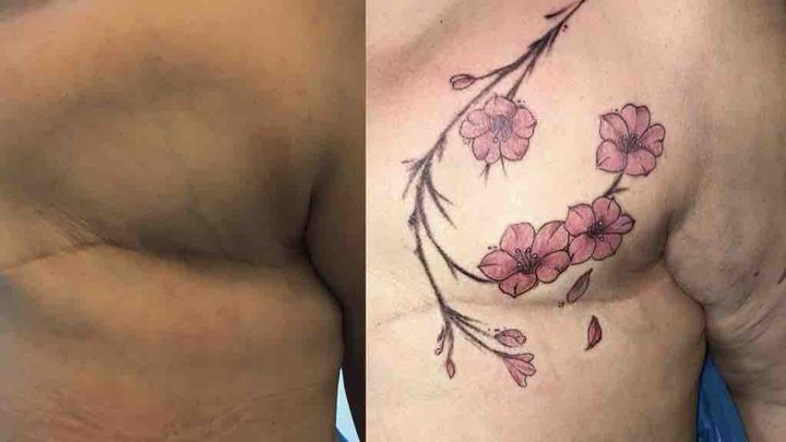 Fundraiser by Anna Cassidy : Tattooing to cover breast cancer scars