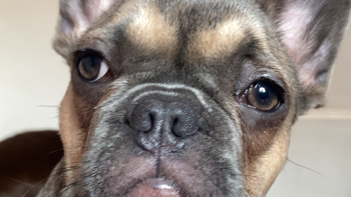 Meila for her surgery campaign photo, 1 of 5