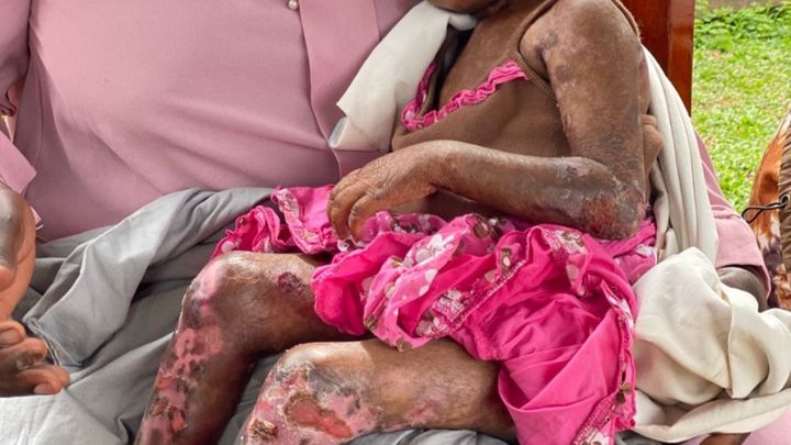 A Life of Pain-Let’s Give Lauza a Chance at Some Comfort campaign photo, 1 of 8