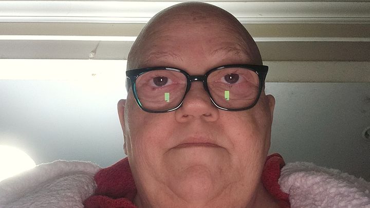Help Sandy Overcome Financial Strain During Chemo campaign photo, 1 of 5