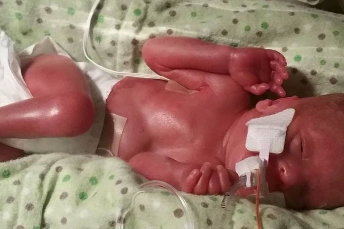 Fundraiser for Rebecca Kochsiek by Lea Gleason : Baby Addy