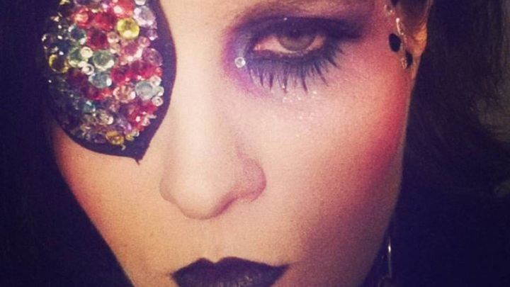 HELP MEL GET A NEW EYE!!! campaign photo, 1 of 3