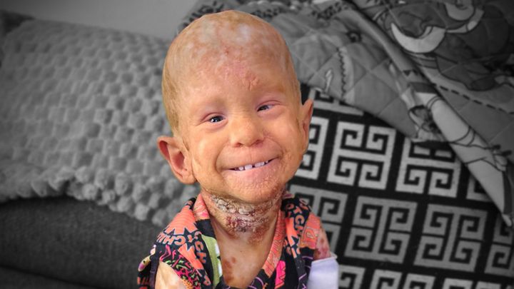 Help Scarlett Defy the Odds with KID Syndrome campaign photo, 1 of 8