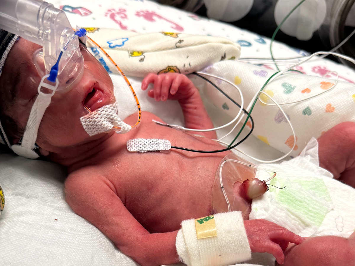 Support Krista and Her NICU Warrior Baby campaign photo, 1 of 4