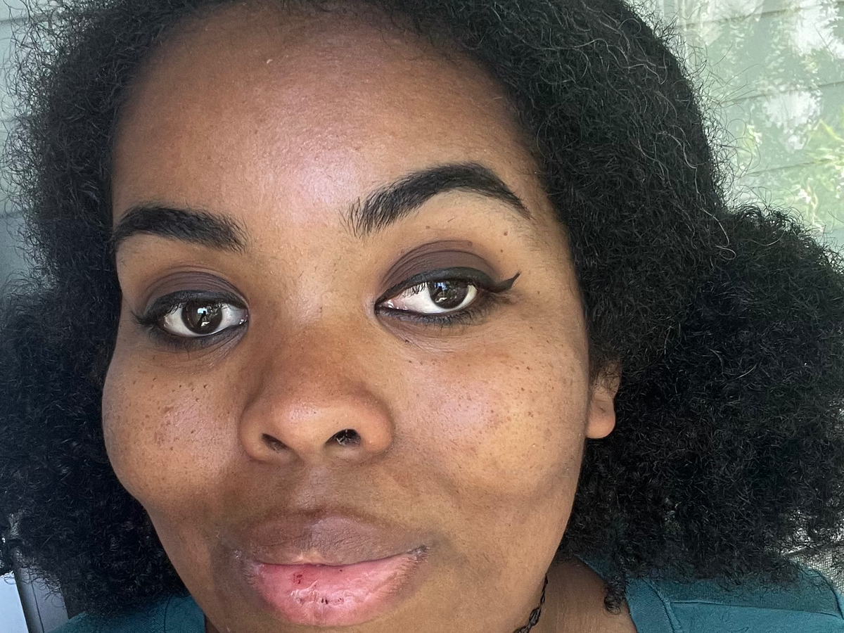 Donate to Ease Beth's Medical Burden campaign photo, 1 of 3
