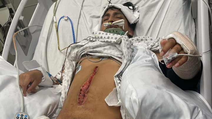 Ayuda para mi hermano quien sufrio un accidente trabajo ……. campaign photo, 1 of 8
