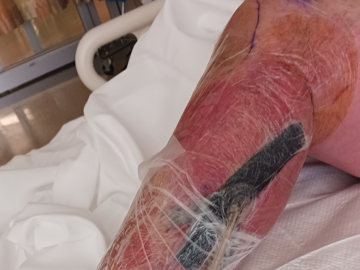 Help Cowboy Recover from Severe Infection campaign photo, 1 of 6