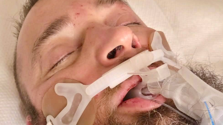 Support Jonathon’s Healing and Recovery campaign photo, 1 of 4