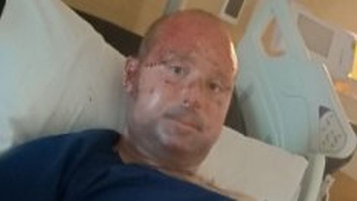 Support Dennis with his ongoing needs and future care . campaign photo, 1 of 8