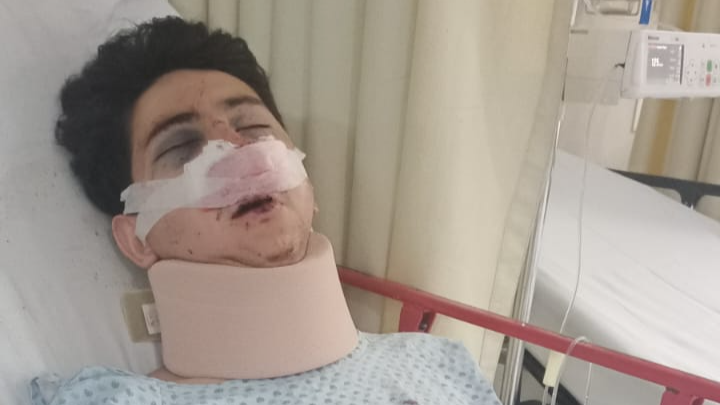 Un accidente cambió todo: César necesita nuestra ayuda campaign photo, 1 of 5