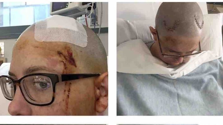 Rare & Painful Brain Implant Complication campaign photo, 1 of 7